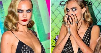 11 femmes qui ont un succès fou dans le monde de la mode malgré leurs imperfections physiques