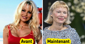 19 Célébrités qui ont adopté la coupe au carré et ont totalement changé de look