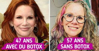 La star de “La petite maison dans la prairie” Melissa Gilbert a dit NON au Botox et a décidé de vieillir naturellement