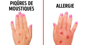 Comment détecter une allergie en 3 étapes ?