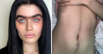 15 Femmes prouvent que les poils corporels ne sont pas à cacher