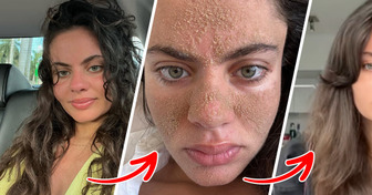 Elle ne lave plus son visage depuis plus d’un mois et sa transformation choque les internautes
