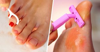 10 Astuces pour tes pieds trop utiles pour ne pas être partagées