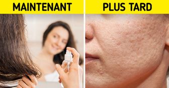 7 Erreurs en matière des soins de la peau qui peuvent donner de l’acné