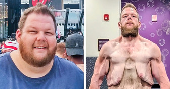 Un homme a perdu 160 kilos et tout le monde parle de son incroyable parcours