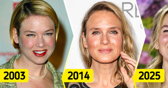 10 Stars qui ont radicalement changé en prenant de l’âge