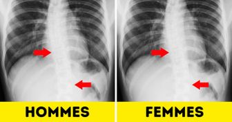 Les hommes sont parfois plus gâtés par la nature que les femmes, en voici quelques exemples
