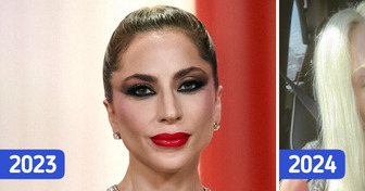 La dernière photo de Lady Gaga fait sensation : «Elle ne se ressemble plus»