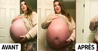 L’énorme ventre d’une femme enceinte donne l’impression qu’elle attend huit bébés