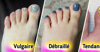 13 Pédicures qui vont sublimer tes pieds cet été