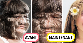 La célèbre “fille la plus poilue du monde” présente une transformation étonnante
