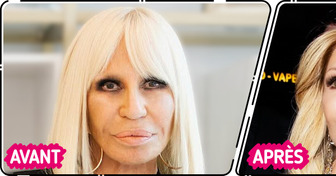 "Ce chirurgien mérite le prix Nobel !" Le nouveau look de Donatella Versace suscite l'émoi sur la toile