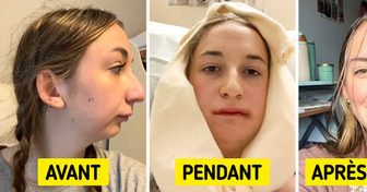 Une jeune femme révèle les résultats spectaculaires de son opération de la mâchoire, laissant les gens stupéfaits
