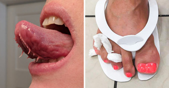 19 Personnes avec des particularités physiques qui les rendent uniques
