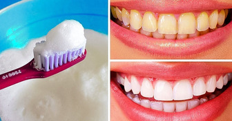 10 Des Meilleurs Moyens Pour Naturellement Blanchir Tes Dents à la Maison