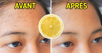 7 Aliments pour résorber tes cicatrices d’acné