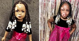 Une artiste renforce l’estime de soi de fillettes atteintes de vitiligo en créant des poupées spécialement pour elles