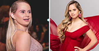 Découvre la belle histoire de cette jeune fille atteinte de trisomie 21 qui fait une incroyable carrière dans le mannequinat