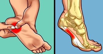 Que faire si ton talon te fait mal le matin ou à chaque fois que tu poses le pied