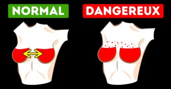 3 Changements au niveau des seins qui sont normaux, et 6 autres qui peuvent être un signe avant-coureur de problèmes de santé