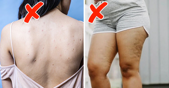 8 Conséquences surprenantes sur ta santé quand tu portes des vêtements trop serrés