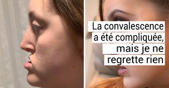 20 Personnes qui ont effectué un changement sur leur visage et qui paraissent différentes