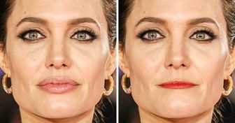 17 Photos qui montrent que retoucher tes lèvres peut modifier complètement ton visage