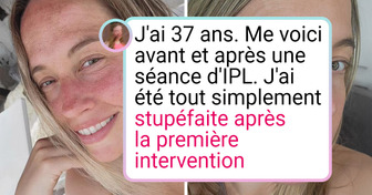 19 Photos avant et après qui montrent clairement ce qu’est le changement