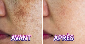 10 Conseils pour réduire la pigmentation du visage de façon naturelle