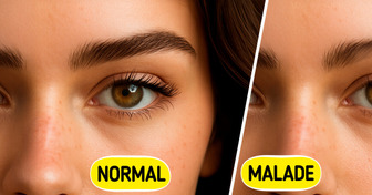 10 Signes discrets indiquant que ta thyroïde ne fonctionne pas bien