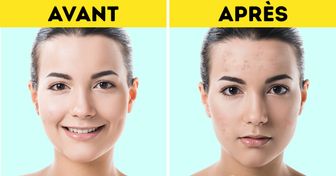 Ces 7 produits cosmétiques sont sur la liste noire des dermatologues !