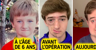 La maladie rare d’un jeune homme a fait de lui un héros inattendu en ligne