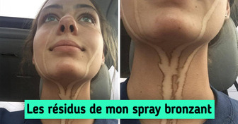 14 Personnes qui sont tellement malchanceuses qu'on a envie de les serrer dans ses bras