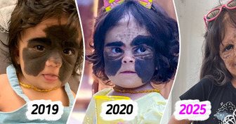 Née avec une tache de naissance sur le visage, elle grandit et fascine par son incroyable évolution