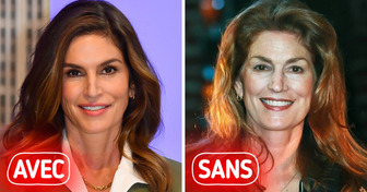 Voici à quoi ces 16 stars ressembleraient sans chirurgie esthétique