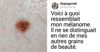 On m’a diagnostiqué un mélanome et je voudrais t’expliquer comment détecter cette maladie à temps