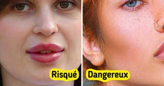 10 Procédures esthétiques qui ne sont pas aussi inoffensives qu’on le croit