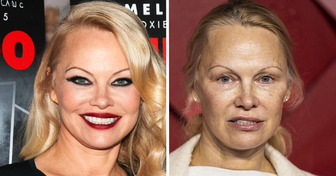 12 Célébrités méconnaissables après leur transformation spectaculaire