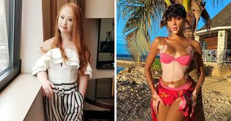10 Top models qui ont changé notre façon de voir la beauté
