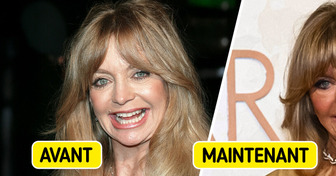 "Elle ne peut plus bouger la bouche" : Goldie Hawn méconnaissable sur le tapis rouge