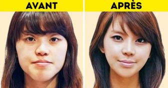 Découvre ces 8 astuces de beauté coréennes insolites qui fonctionnent vraiment !