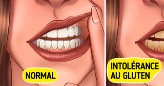 11 Signes d’intolérance au gluten que les gens ont tendance à négliger