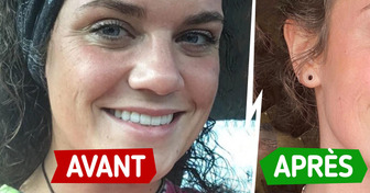 10 Personnes qui ont transformé leur peau en changeant simplement leur routine beauté
