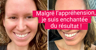 17 Visages de femmes métamorphosés grâce à leurs nouveaux sourcils