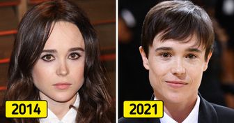15+ Célébrités qui ont changé de façon spectaculaire au cours de la dernière décennie