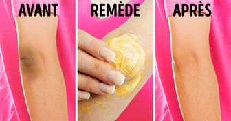 Découvre 10 remèdes naturels qui te permettront d’éclaircir la peau de tes genoux et de tes coudes !