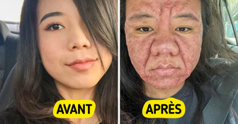 Cette femme dévoile sans filtre la réalité de la grossesse