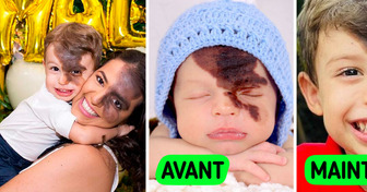 Une maman est prête à tout pour mettre son fils à l’aise et l’aider à accepter sa tache de naissance