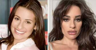 12 Stars dont l’apparence a radicalement changé après la chirurgie plastique