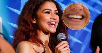 Pourquoi le sourire de Zendaya séduit autant à l’ère des facettes ultra-blanches